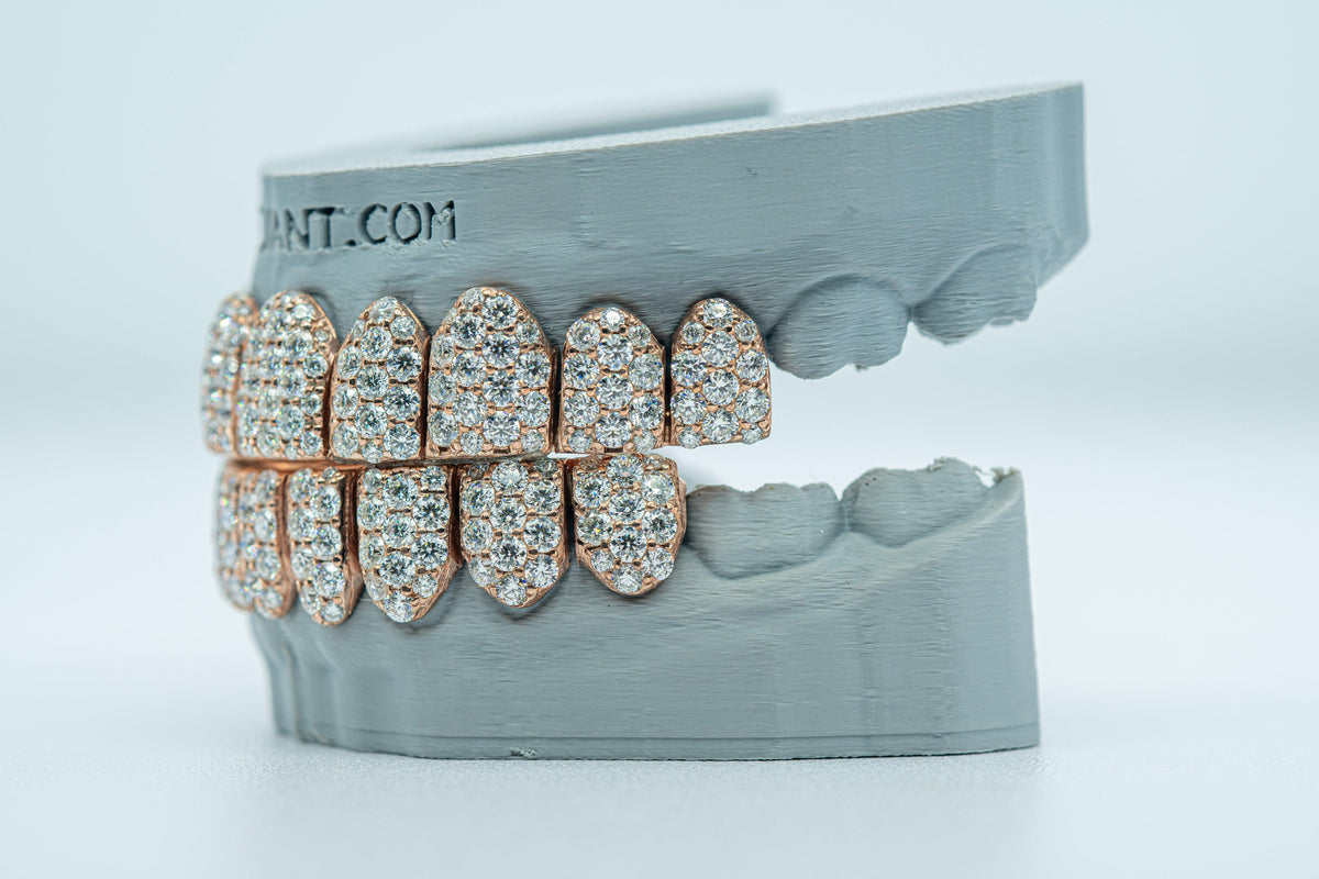 Jumbo (6 Pointer) VVS Moissanite Diamond Grillz - Agoradiant
