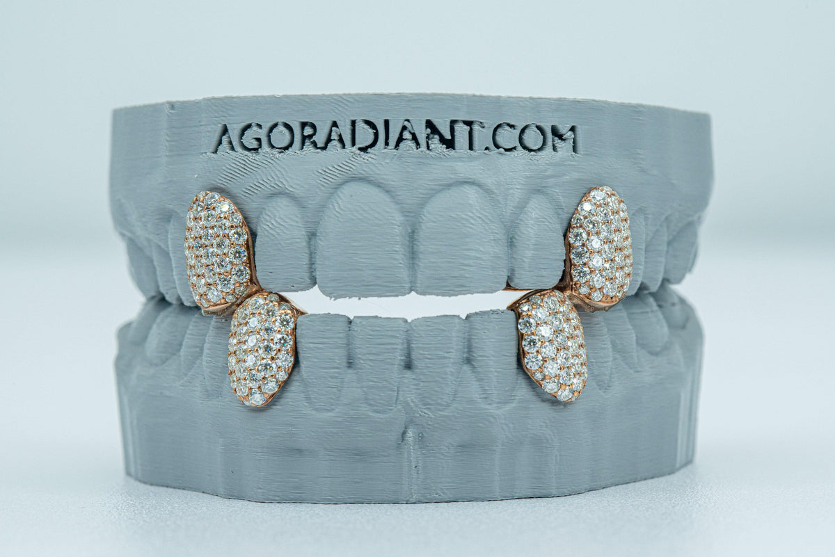 Fang With Back Bar VVS Moissanite Diamond Grillz - Agoradiant