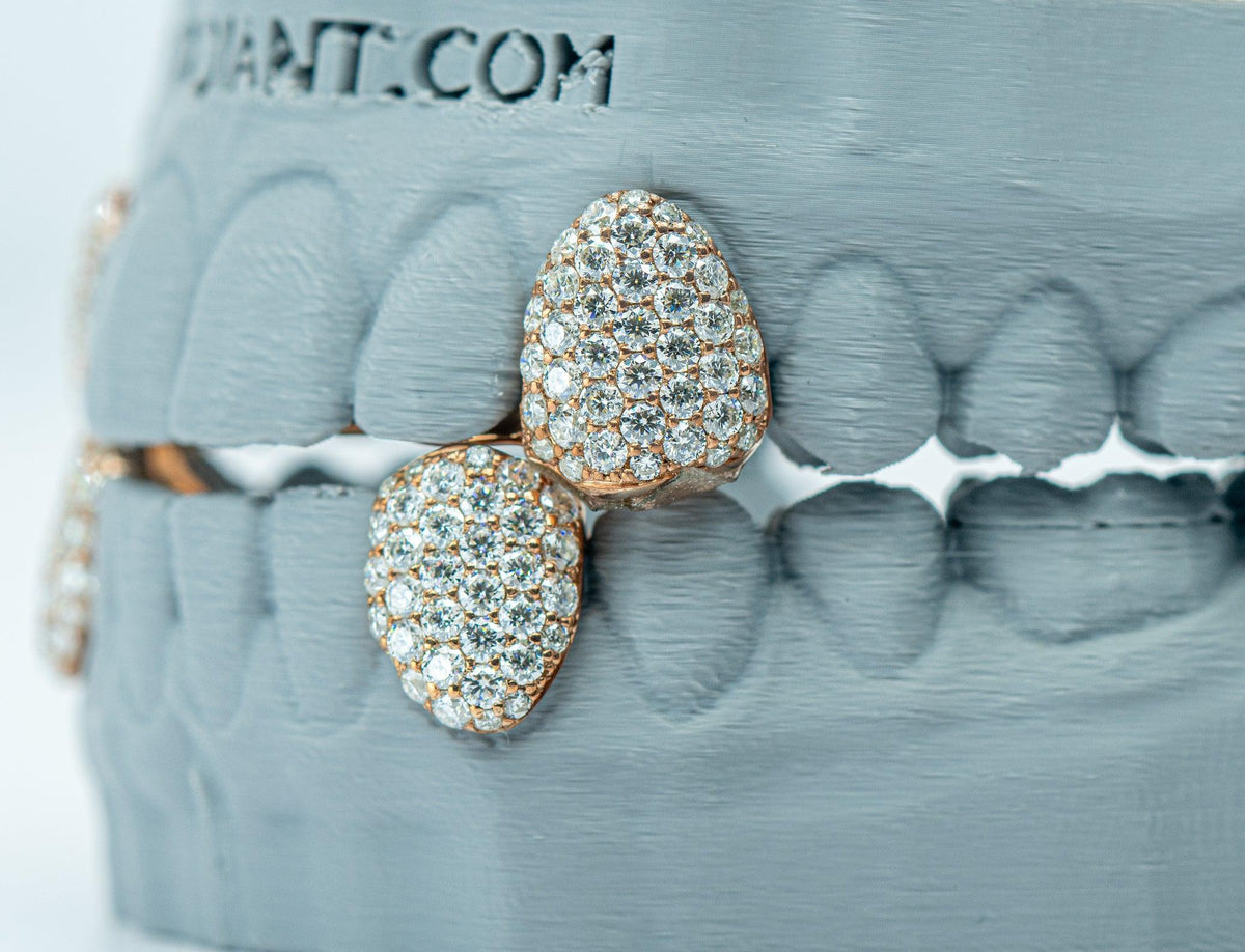 Fang With Back Bar VVS Moissanite Diamond Grillz - Agoradiant