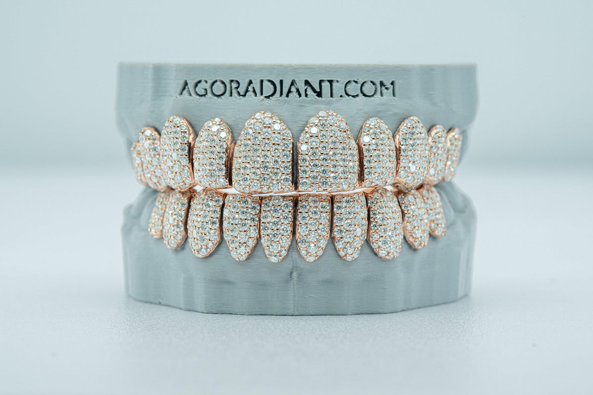 Full Bust Down VVS Moissanite Diamond Grillz - Agoradiant