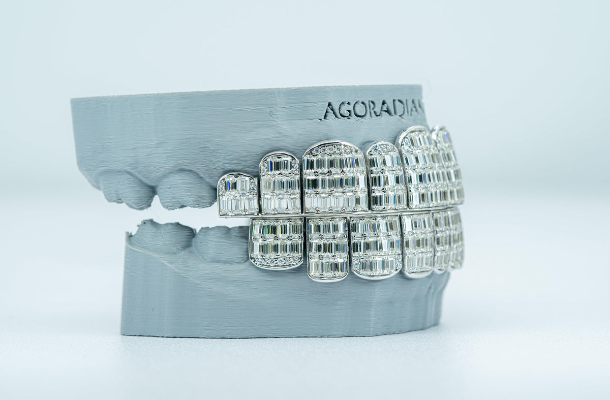 Emerald VVS Moissanite Diamond Grillz - Agoradiant