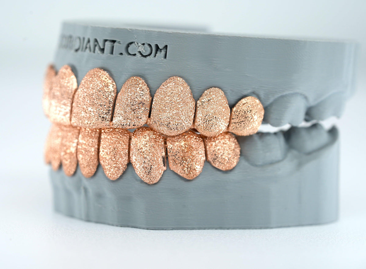 Diamond Dust Grillz - Agoradiant