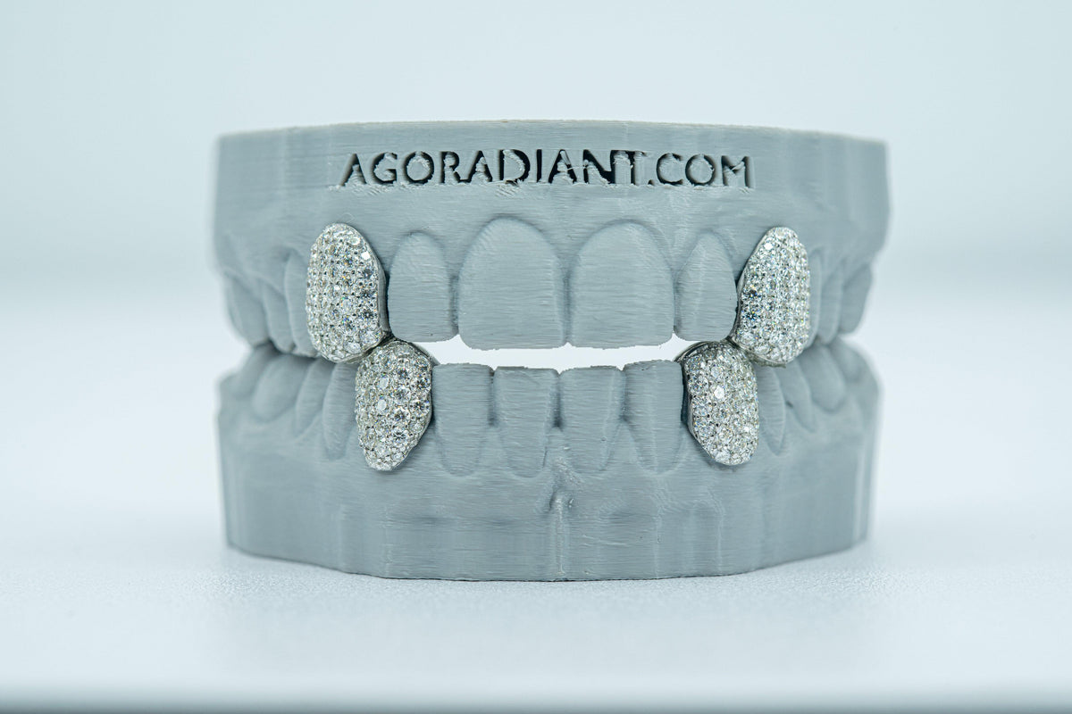 Fang With Back Bar VVS Moissanite Diamond Grillz - Agoradiant
