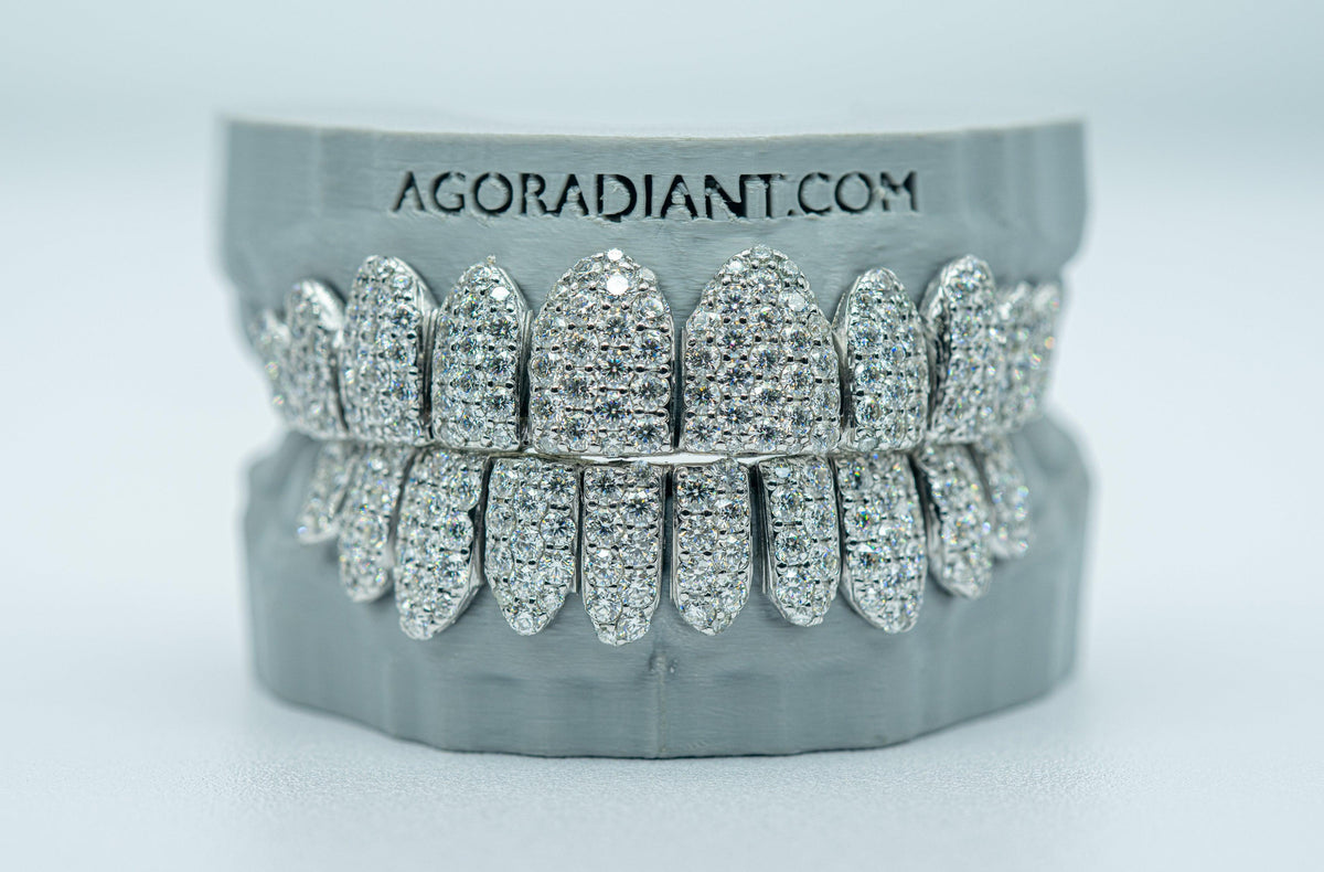 Jumbo (6 Pointer) VVS Moissanite Diamond Grillz - Agoradiant