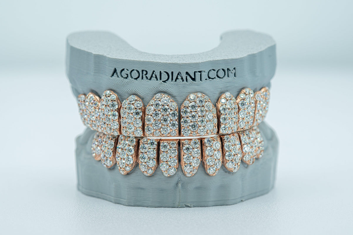 Jumbo (6 Pointer) VVS Moissanite Diamond Grillz - Agoradiant