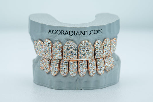 Jumbo (6 Pointer) VVS Moissanite Diamond Grillz - Agoradiant