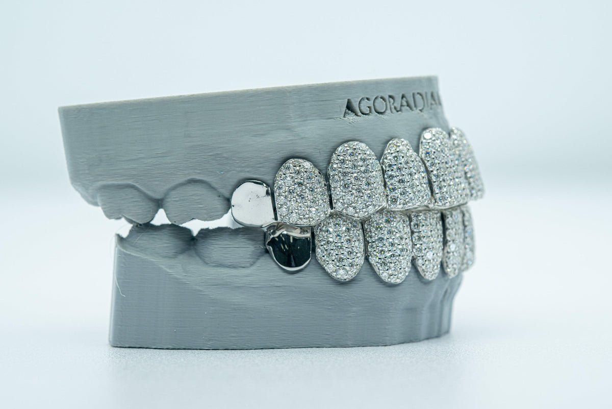 End Cap VVS Moissanite Diamond Grillz - Agoradiant