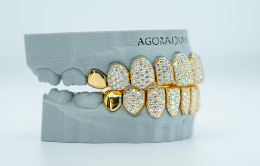 End Cap VVS Moissanite Diamond Grillz - Agoradiant