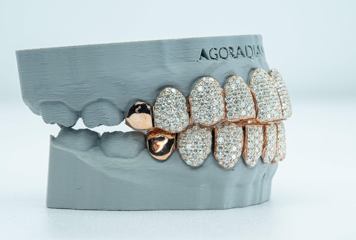 End Cap VVS Moissanite Diamond Grillz - Agoradiant