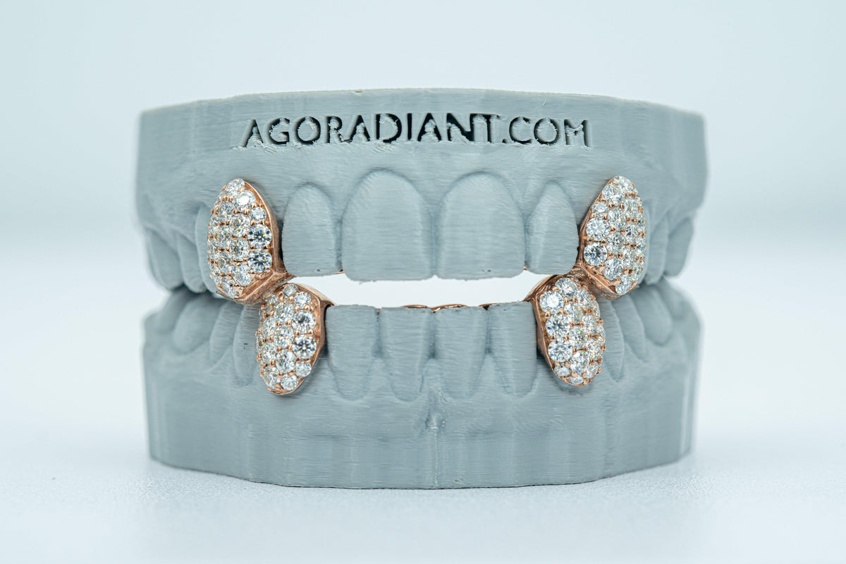 Fang With Back Bar 6 Pointer VVS Moissanite Diamond Grillz - Agoradiant