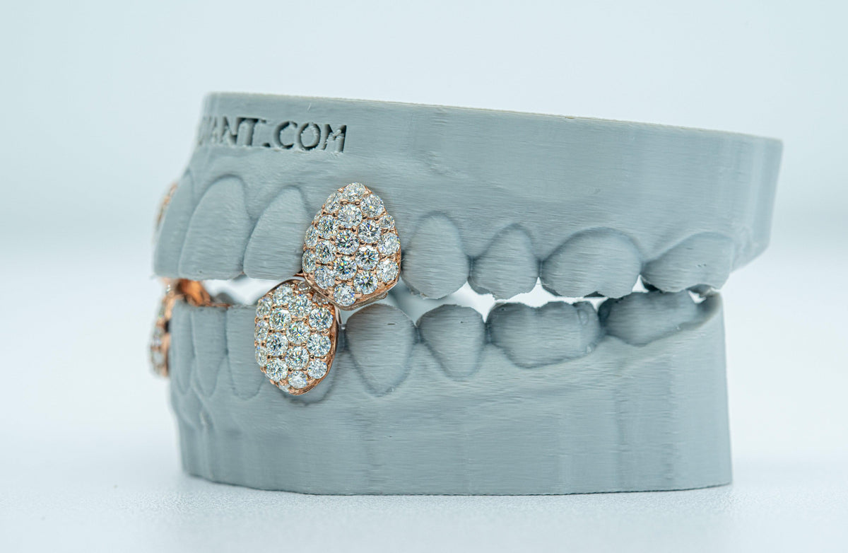 Fang With Back Bar 6 Pointer VVS Moissanite Diamond Grillz - Agoradiant