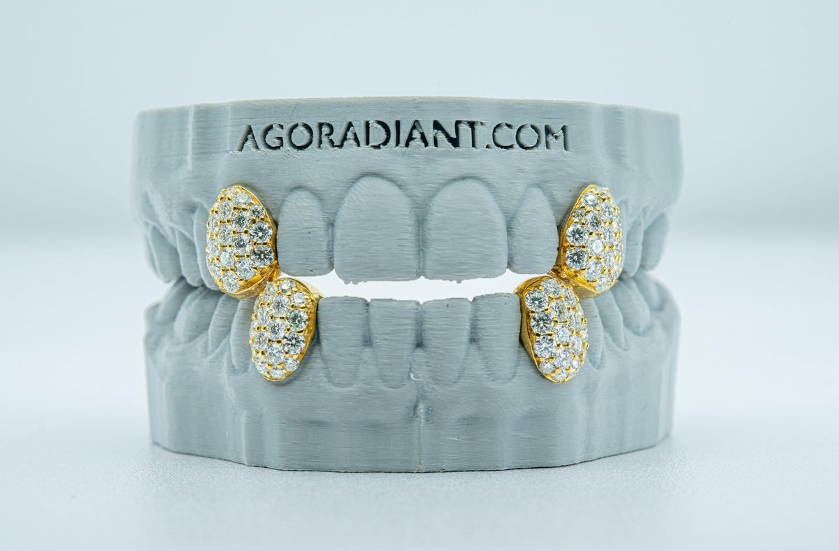 Fang With Back Bar 6 Pointer VVS Moissanite Diamond Grillz - Agoradiant