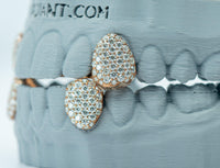 Fang With Back Bar VVS Moissanite Diamond Grillz
