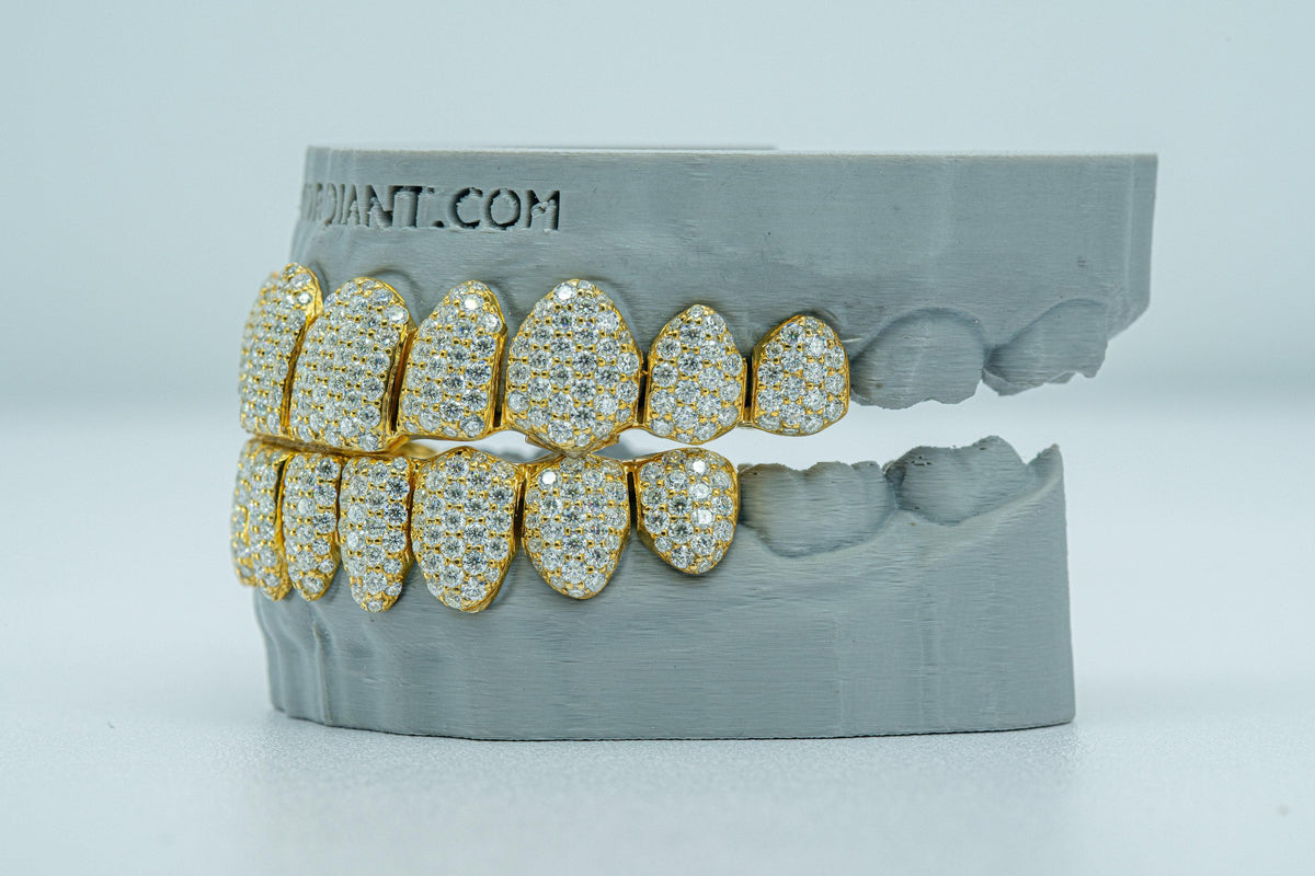 Full Bust Down VVS Moissanite Diamond Grillz - Agoradiant
