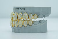 Full Bust Down VVS Lab Diamond Grillz