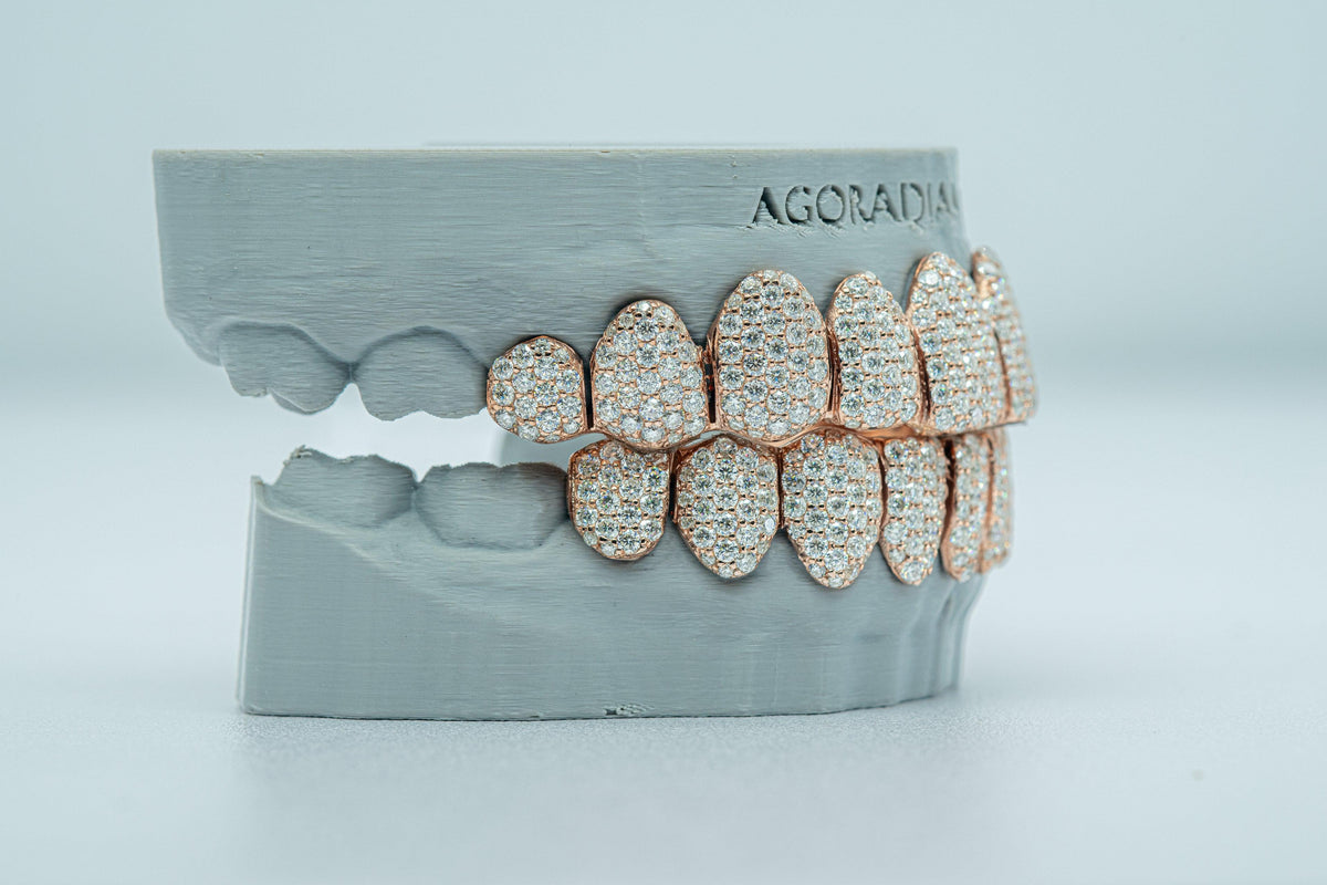 Full Bust Down VVS Moissanite Diamond Grillz - Agoradiant