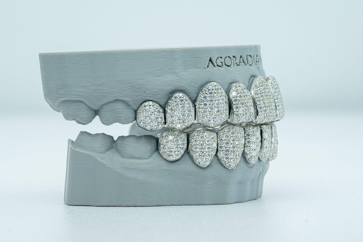 Full Bust Down VVS Moissanite Diamond Grillz - Agoradiant