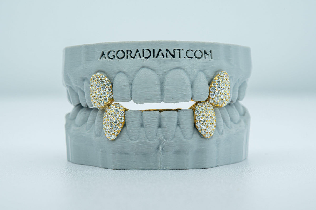 Fang With Back Bar VVS Moissanite Diamond Grillz - Agoradiant