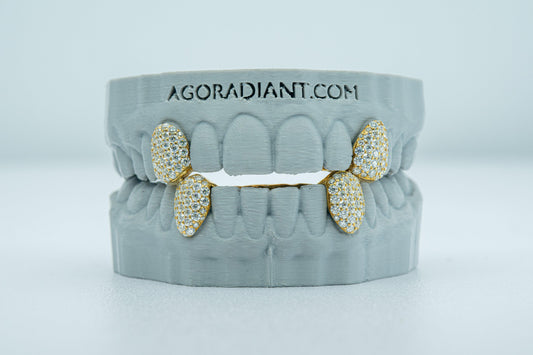 Fang With Back Bar VVS Moissanite Diamond Grillz - Agoradiant