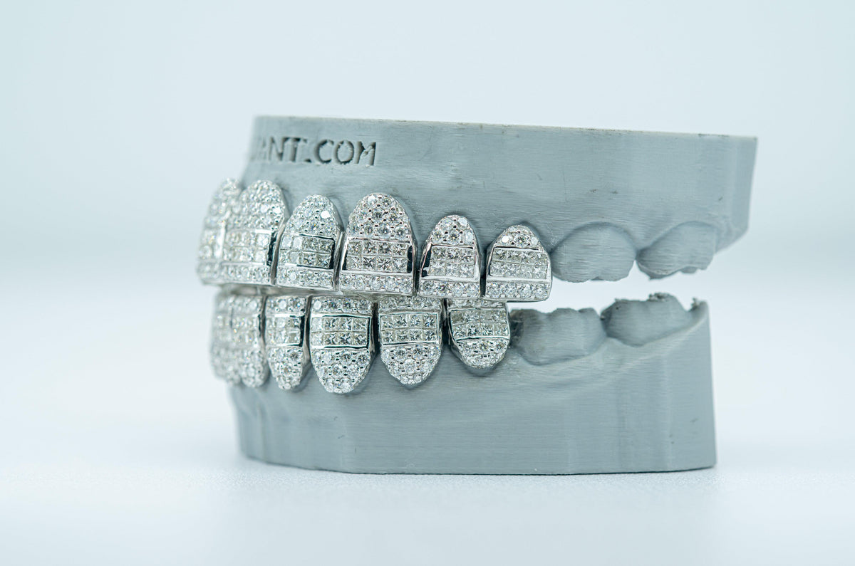 Hybrid VVS Lab diamond Grillz - Agoradiant