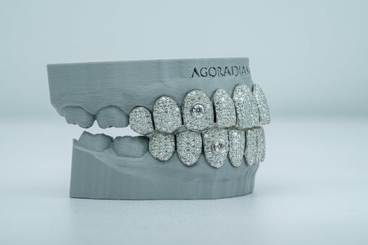 15 Pointer Stone On Fang VVS Moissanite Diamond Grillz - Agoradiant