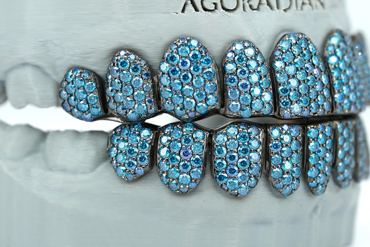 Blue VVS Moissanite Diamond Grillz - Agoradiant