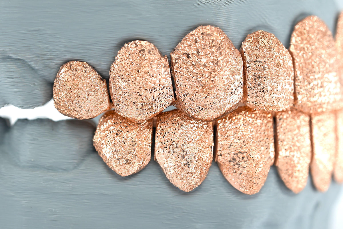 Diamond Dust Grillz - Agoradiant