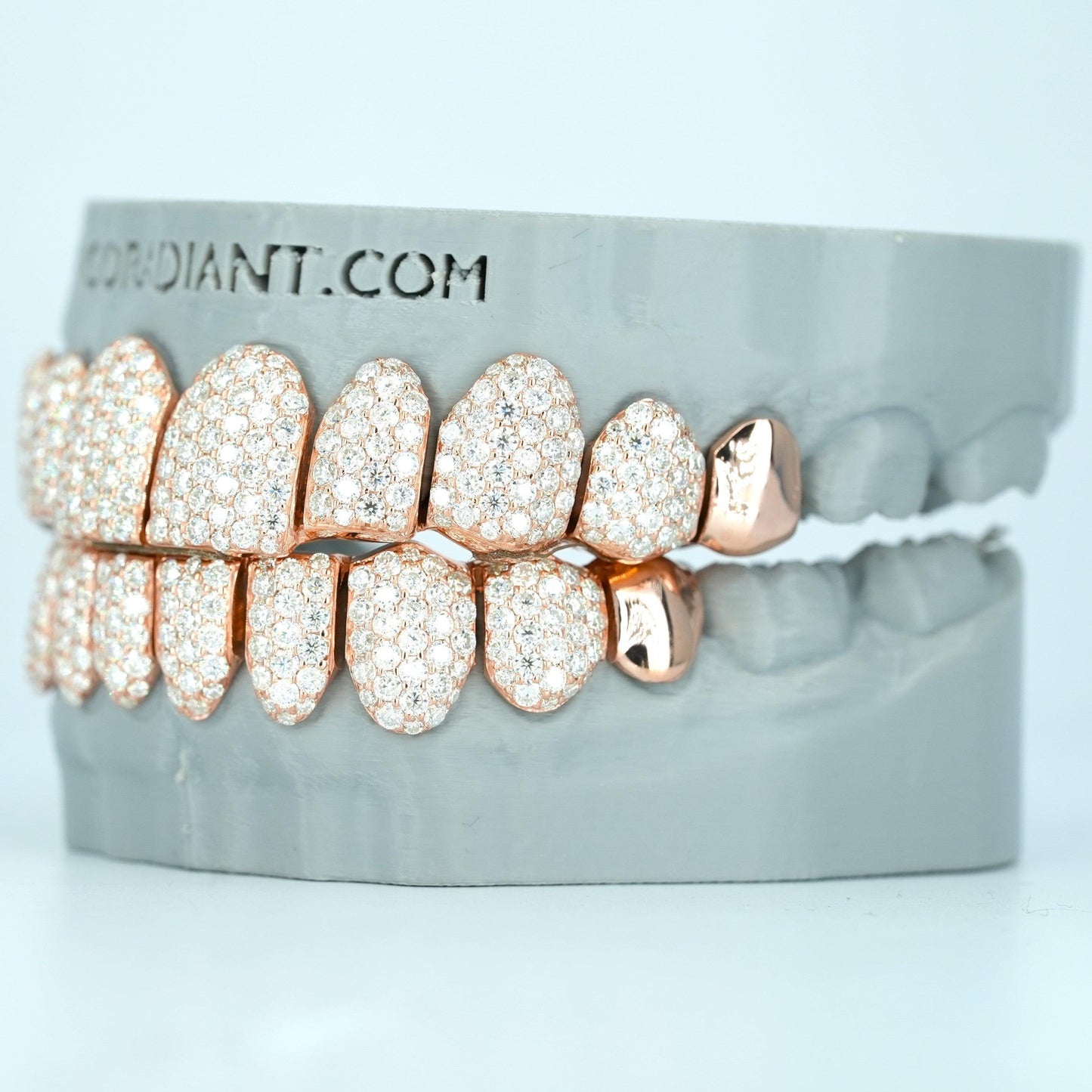 End Cap VVS Moissanite Diamond Grillz - Agoradiant