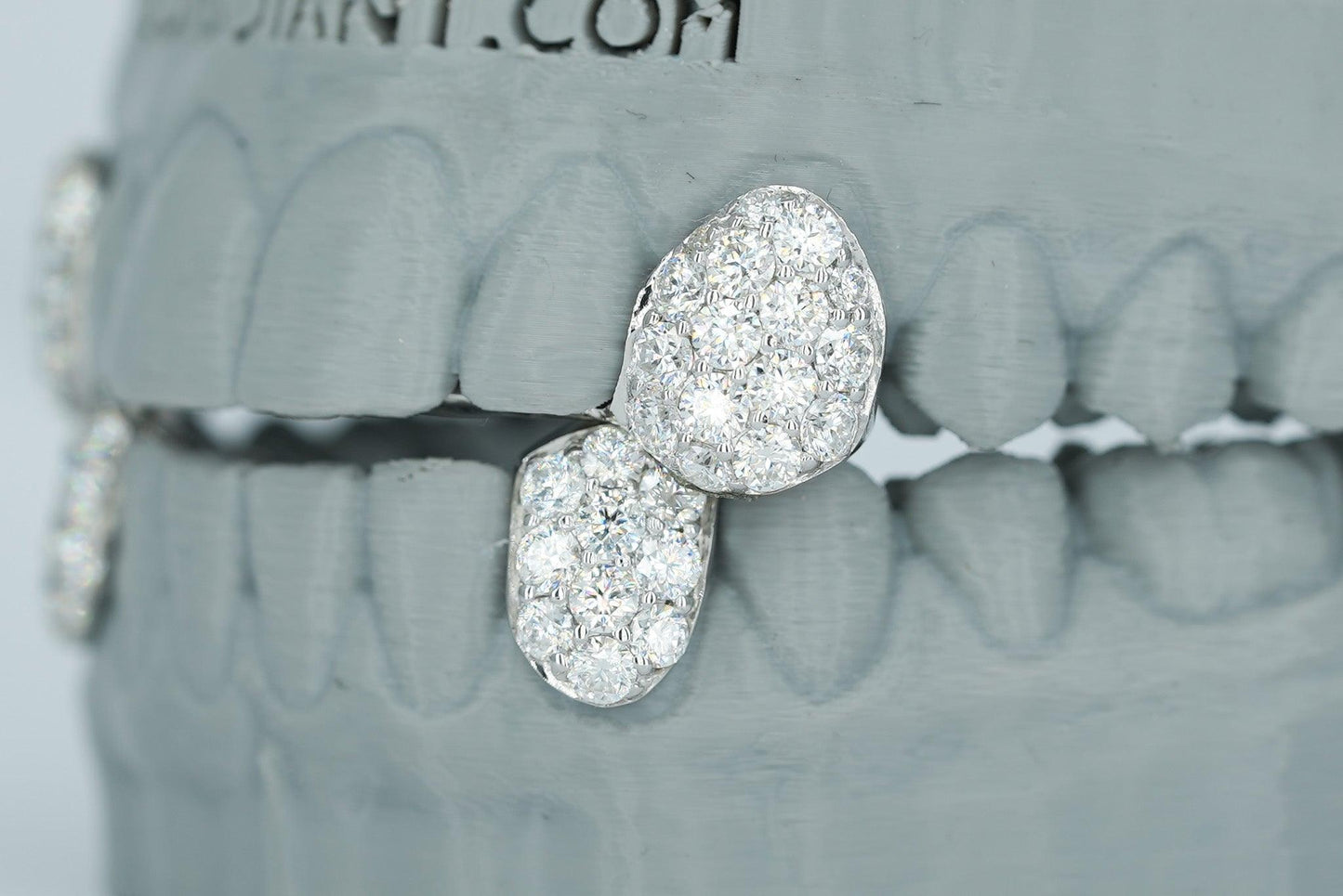 Fang With Back Bar 6 Pointer VVS Moissanite Diamond Grillz - Agoradiant