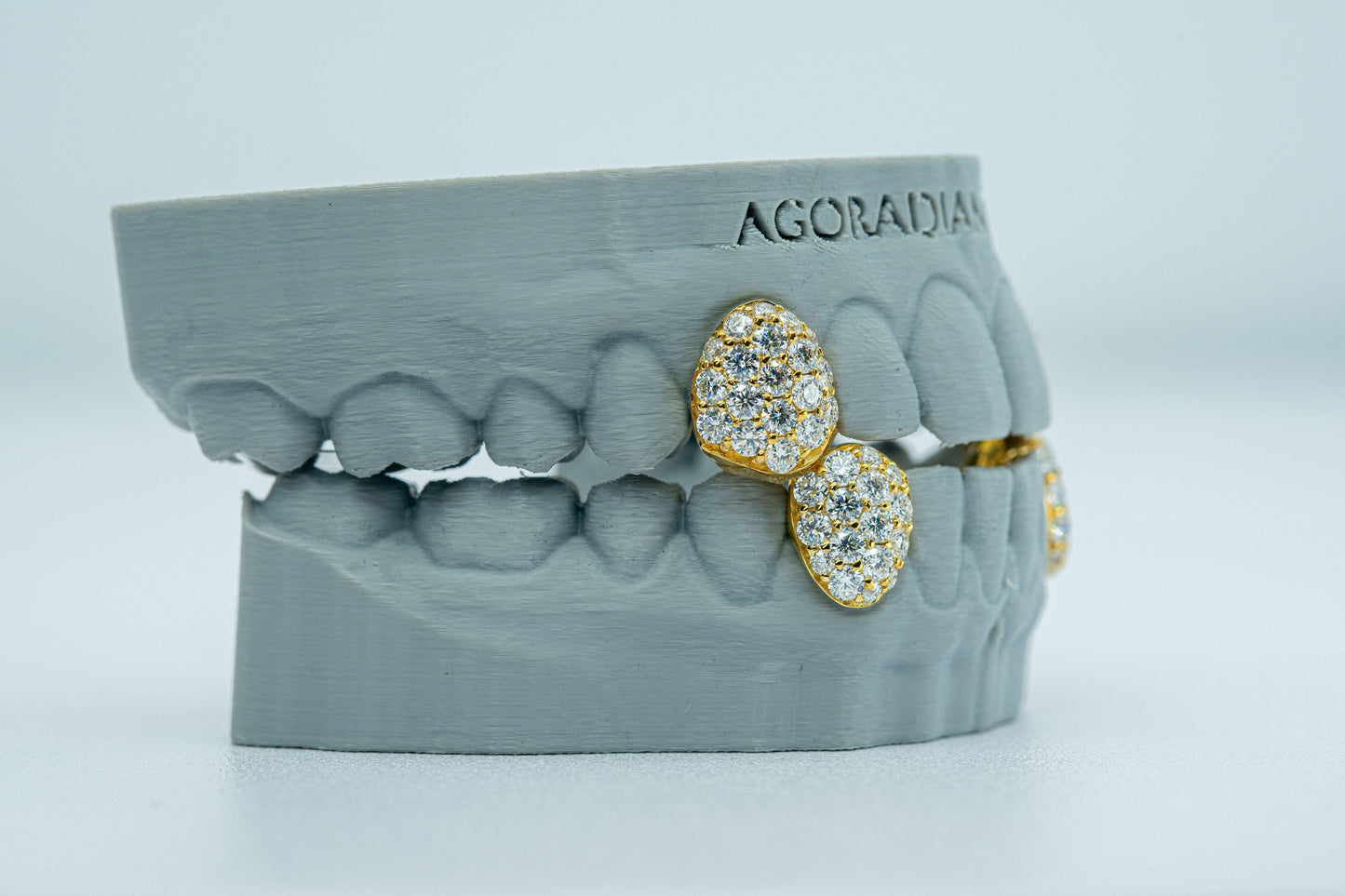 Fang With Back Bar 6 Pointer VVS Moissanite Diamond Grillz - Agoradiant