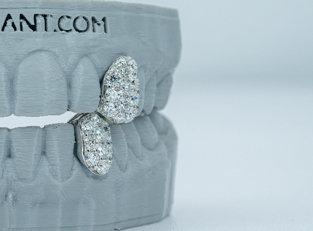 Fang With Back Bar 6 Pointer VVS Moissanite Diamond Grillz - Agoradiant