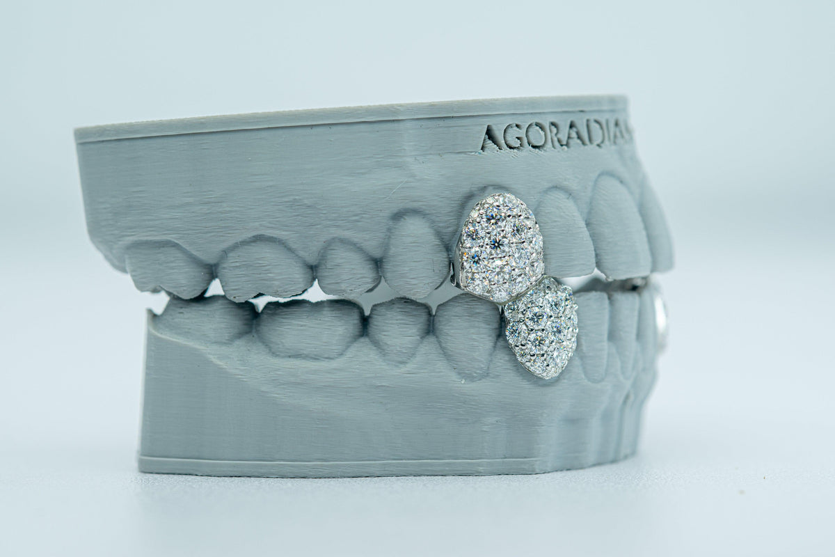 Fang With Back Bar 6 Pointer VVS Moissanite Diamond Grillz - Agoradiant