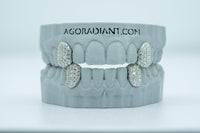 Fang With Back Bar VVS Moissanite Diamond Grillz