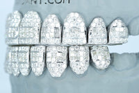 Hybrid VVS Moissanite Diamond Grillz