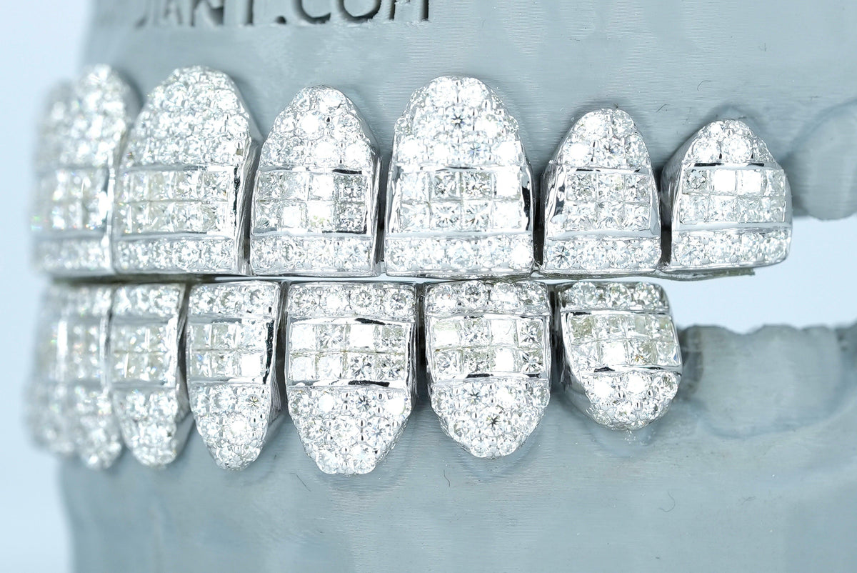 Hybrid VVS Moissanite Diamond Grillz - Agoradiant