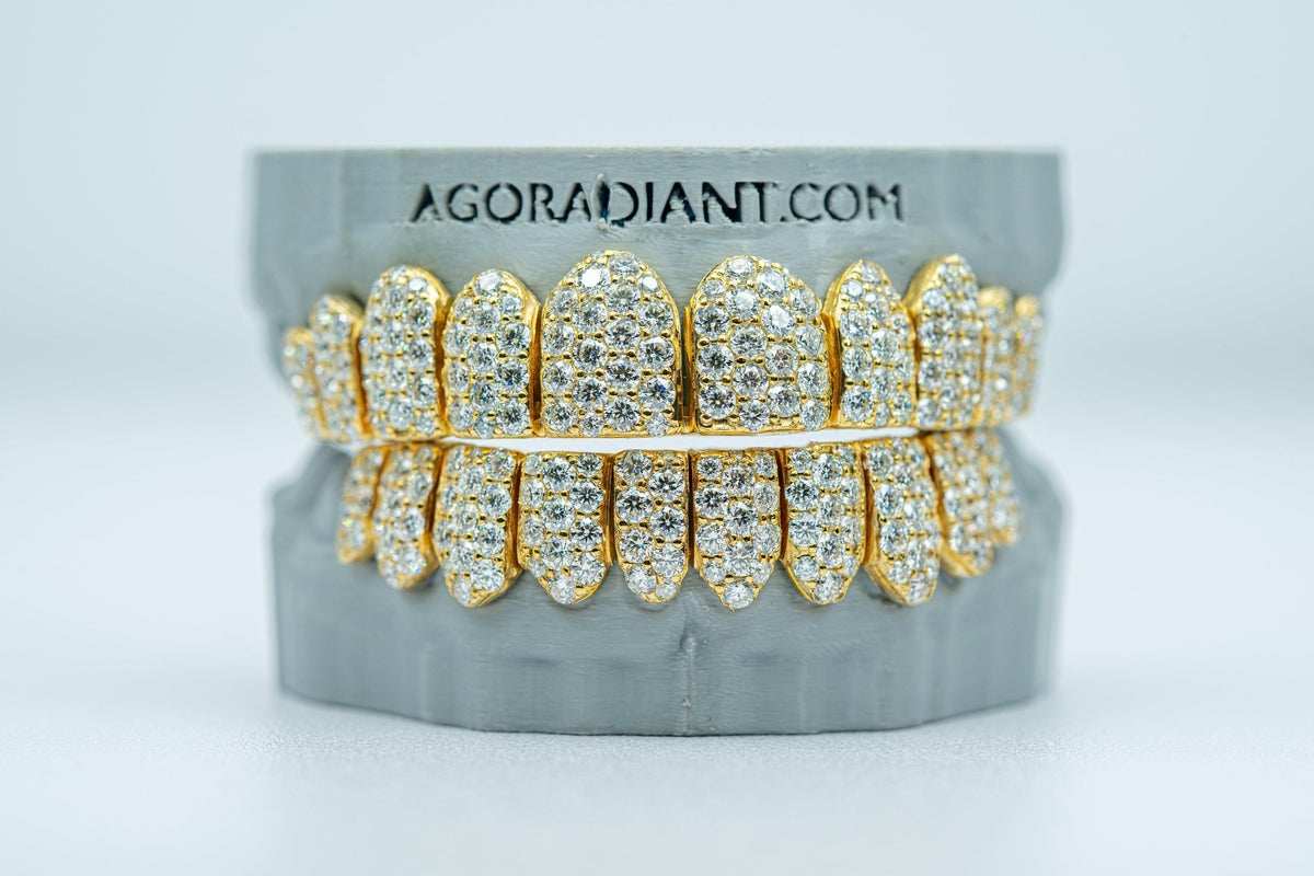 Jumbo (6 Pointer) VVS Moissanite Diamond Grillz - Agoradiant