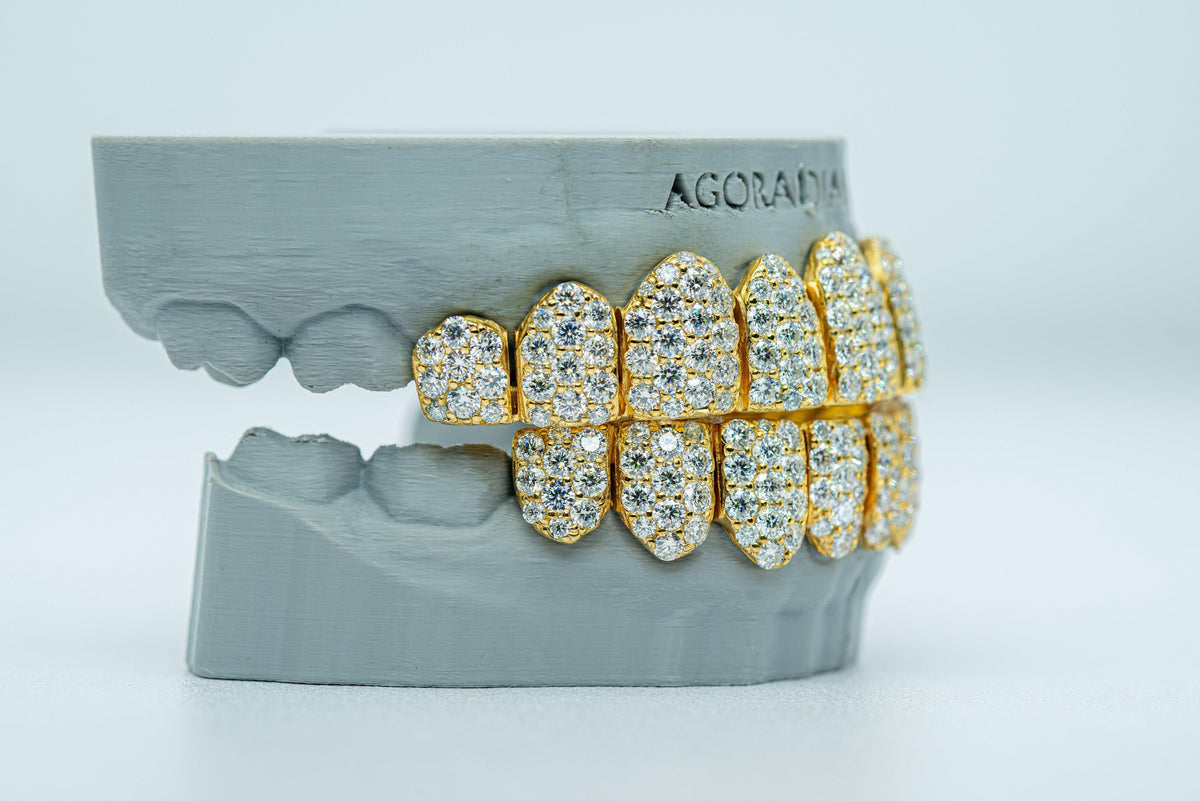 Jumbo (6 Pointer) VVS Moissanite Diamond Grillz - Agoradiant