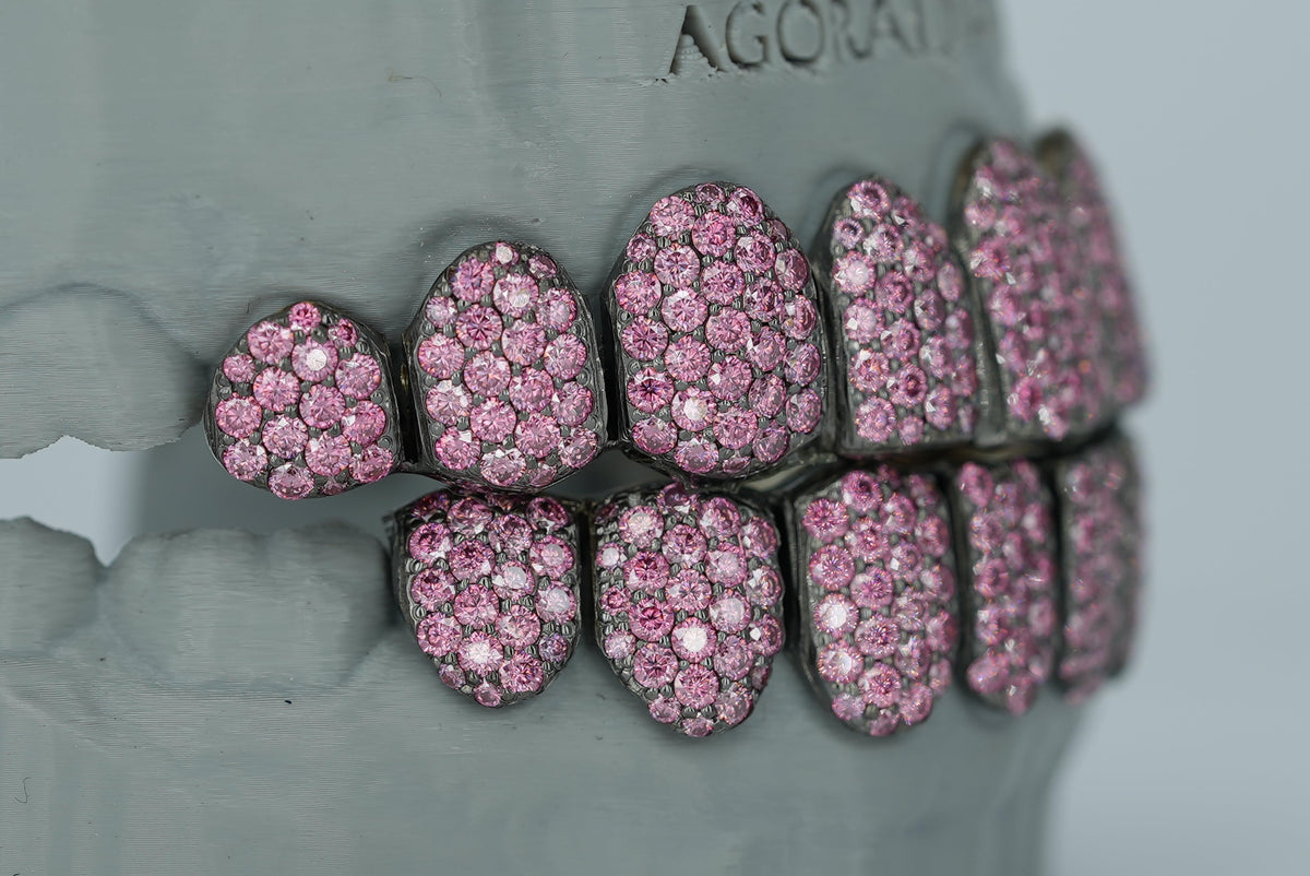 Valentine Pink VVS Moissanite Diamond Grillz - Agoradiant